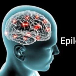 Bệnh Động Kinh Epilepsy Là Gì? Làm Sao Để Nhận Biết Bệnh Này?